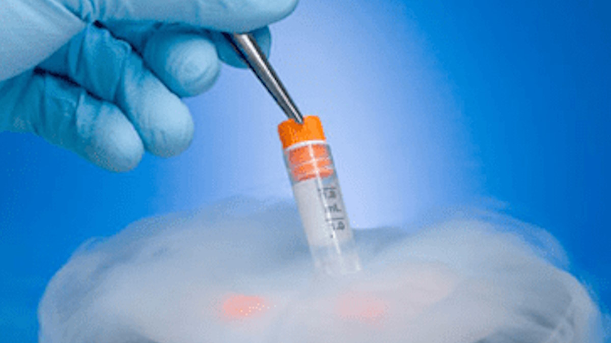 Sperm Freezing