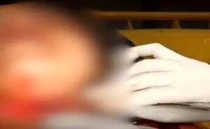 प्रेमी-प्रेमिका गए थे घूमने : विवाद के बाद हो गई चाकूबाजी, प्रेमी की मौत प्रेमिका गंभीर
