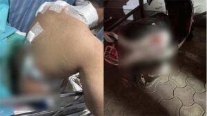 भेल खाने के दौरान कांग्रेस नेता के बेटे पर चाकू से हमला, हालत गंभीर, आरोपी फरार