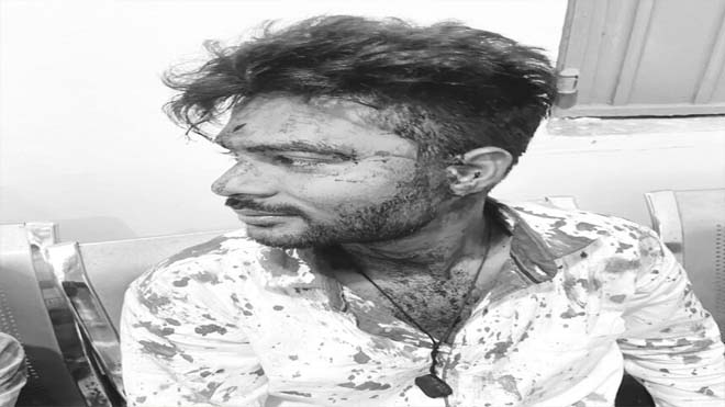 पुरानी रंजिश मे युवक पर जानलेवा हमला, पुलिस ने किया एफआईआर दर्ज