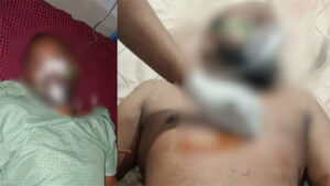 बाइक हटाने के विवाद में चाकूबाजी, बचाने गए युवकों पर जानलेवा हमला