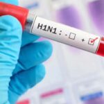 तेजी से फैल रहा स्‍वाइन फ्लू! युवक की मौत के बाद H1N1 रिपोर्ट पॉजिटिव, जिले में अब तक 6 संदिग्ध मरीज