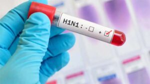तेजी से फैल रहा स्‍वाइन फ्लू! युवक की मौत के बाद H1N1 रिपोर्ट पॉजिटिव, जिले में अब तक 6 संदिग्ध मरीज