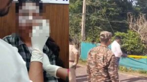 लायब्रेरी से घर जा रही युवती पर एसीड अटैक : गंभीर हालत मे अस्पताल मे कराया गया भर्ती, पुलिस जांच मे जुटी