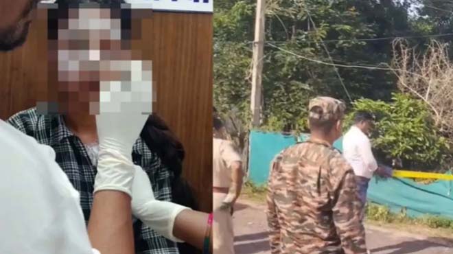 लायब्रेरी से घर जा रही युवती पर एसीड अटैक : गंभीर हालत मे अस्पताल मे कराया गया भर्ती, पुलिस जांच मे जुटी