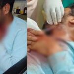 आपसी विवाद ने लिया हिंसक रूप : अस्पताल संचालक की गर्दन पर चाकू से ताबड़तोड़ वार, भाजपा नेता समेत 3 गिरफ्तार