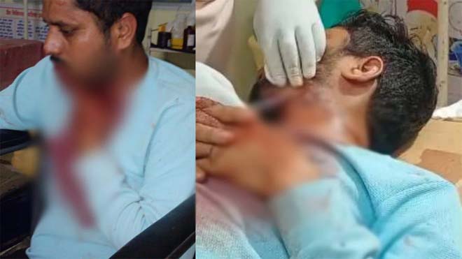 आपसी विवाद ने लिया हिंसक रूप : अस्पताल संचालक की गर्दन पर चाकू से ताबड़तोड़ वार, भाजपा नेता समेत 3 गिरफ्तार