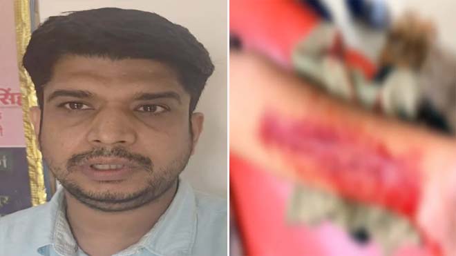सूरजपुर दोहरा हत्याकांड : जेल में बंद आरोपी ने की आत्महत्या की कोशिश, धारदार हथियार से काटा हाथों की नस